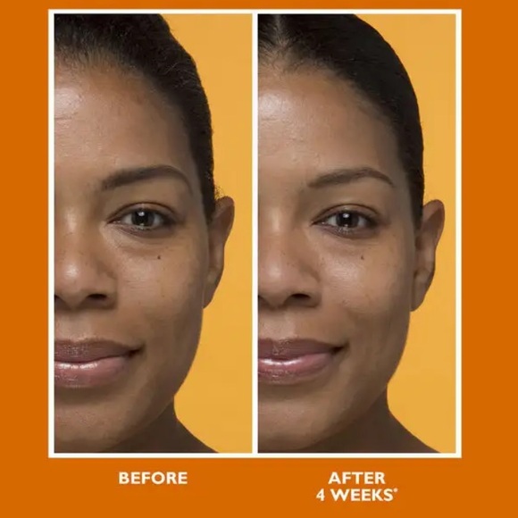 Potent-C Vitamin C Bright & Plump Moisturizer • Peter Thomas Roth • 🆕Full Size - Picture 5 of 10